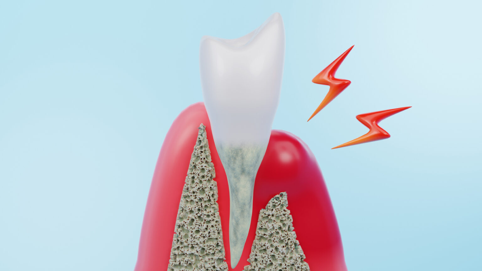 Severe Periodontal Disease: Diagnosis, Treatment and Prevention | Body ...
