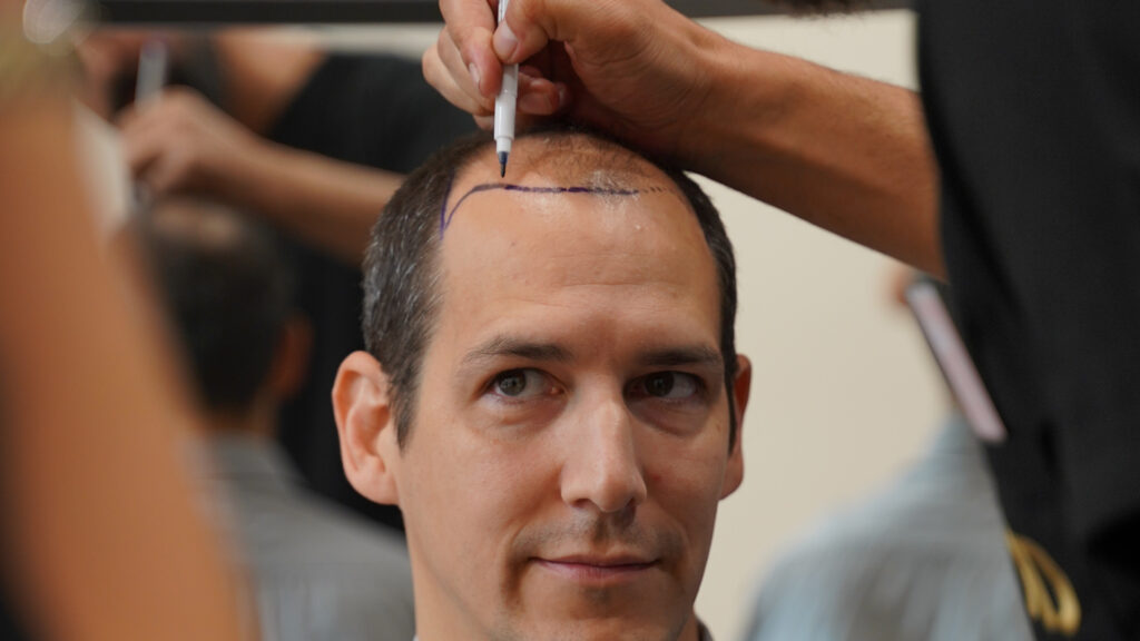 Un professionnel dessine une ligne sur le front d’un homme assis
