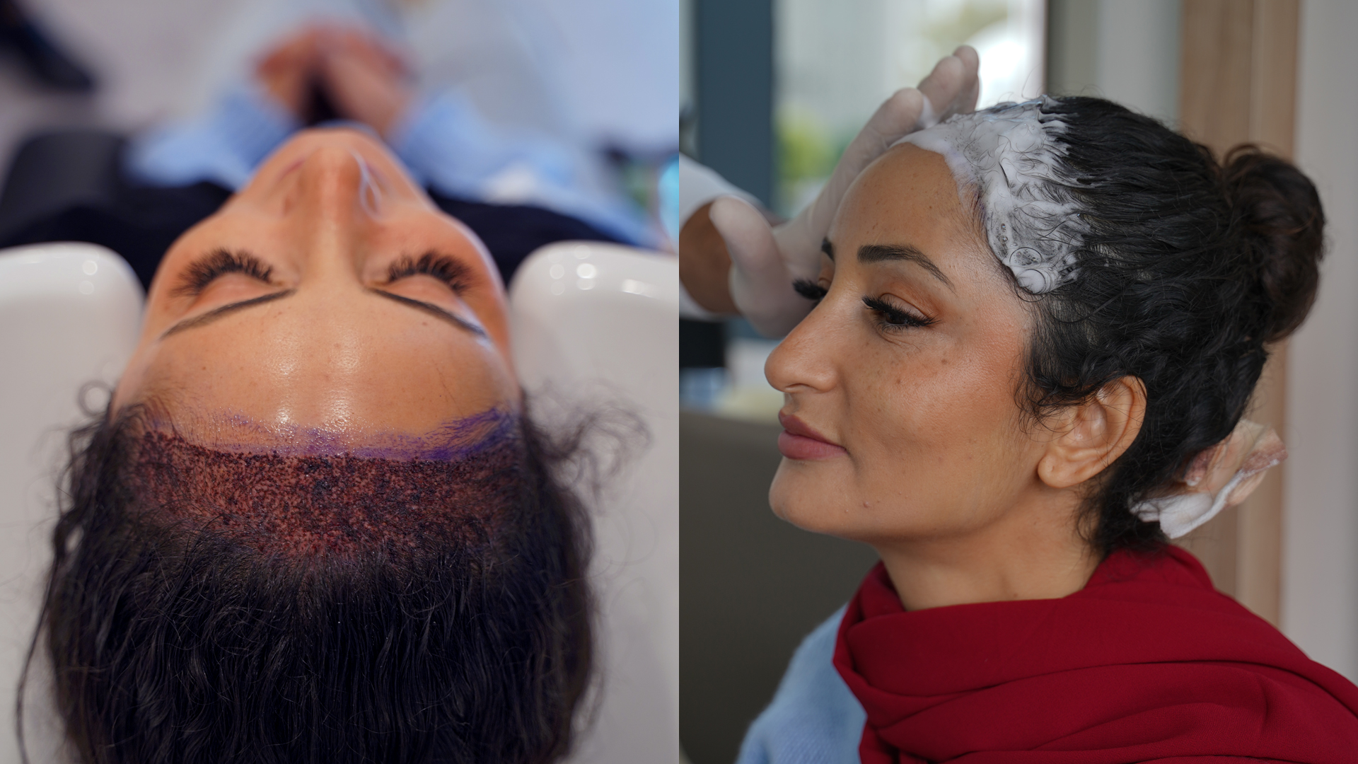 Deux photographies de femmes pendant des soins du cuir chevelu