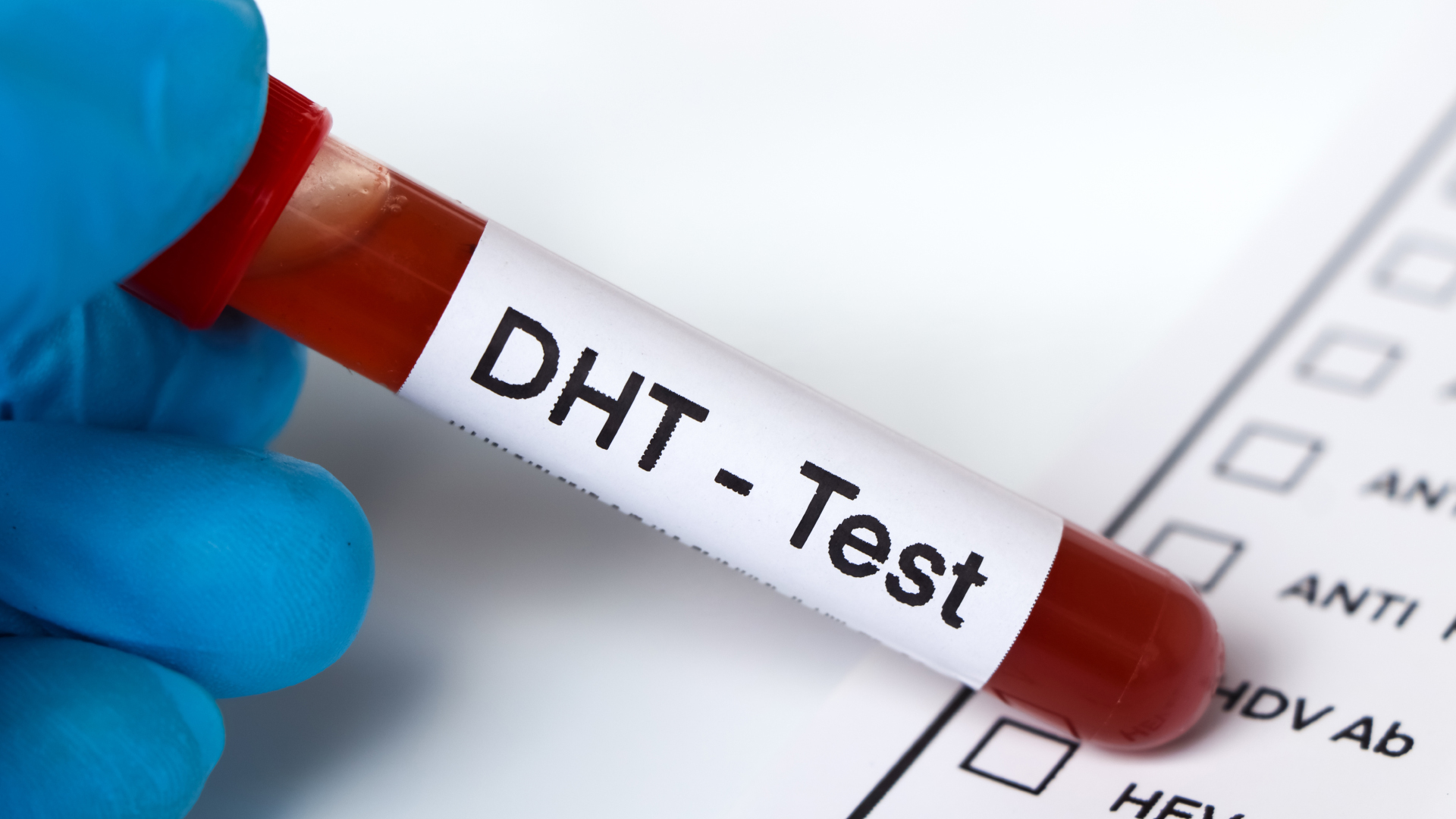 Main gantée tenant un tube portant la mention DHT-Test