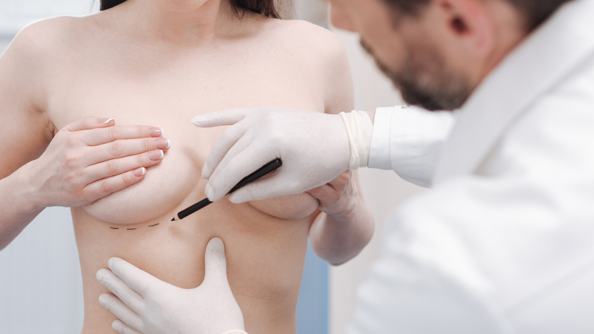 Gloved surgeon marking out the chest of a patient with a pen before breast surgery