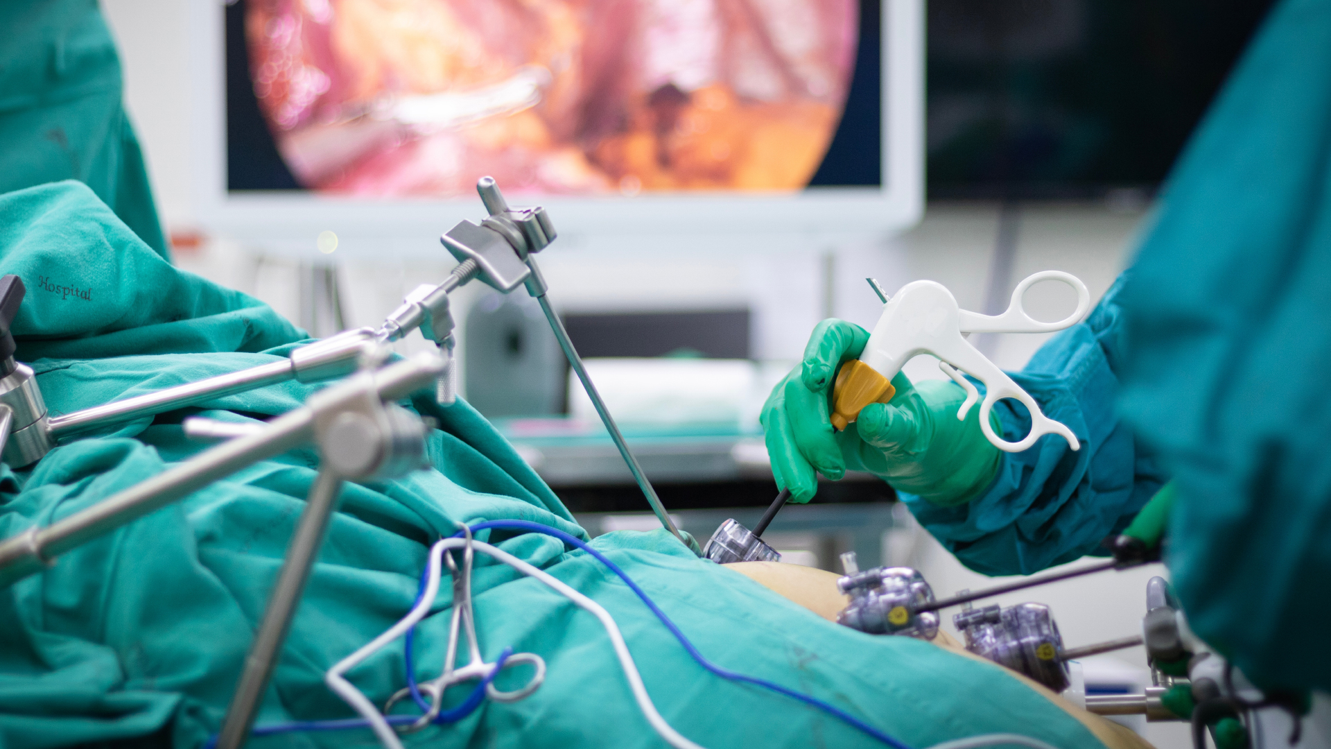 Laparoscopic procedure in an operating theatre, instruments in place and a monitor in the background