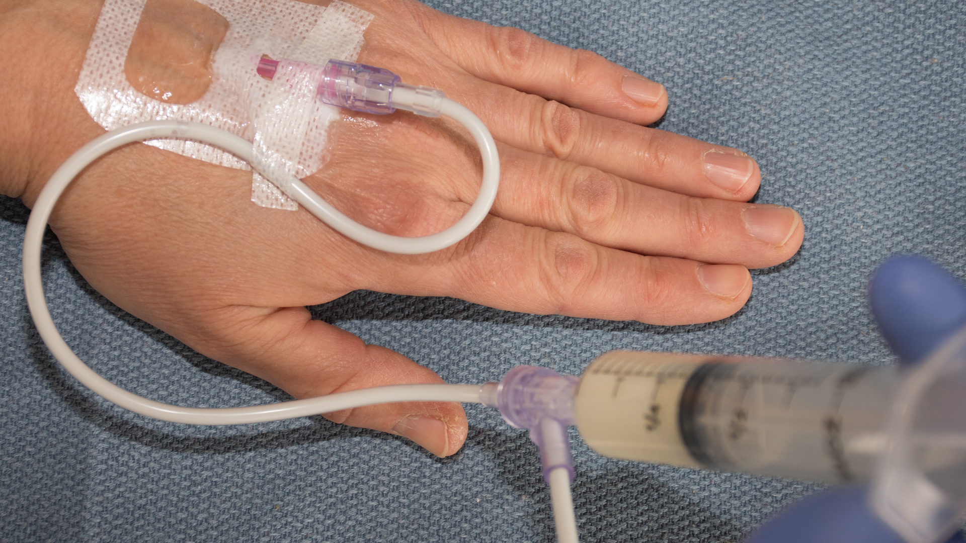 Patient's hand resting on a sheet with an intravenous cannula and giving set taped in place