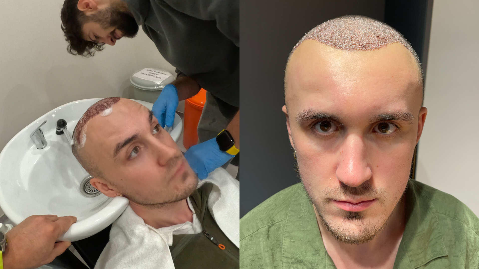Deux photographies d’un homme, au bac de lavage et avec des cheveux très courts