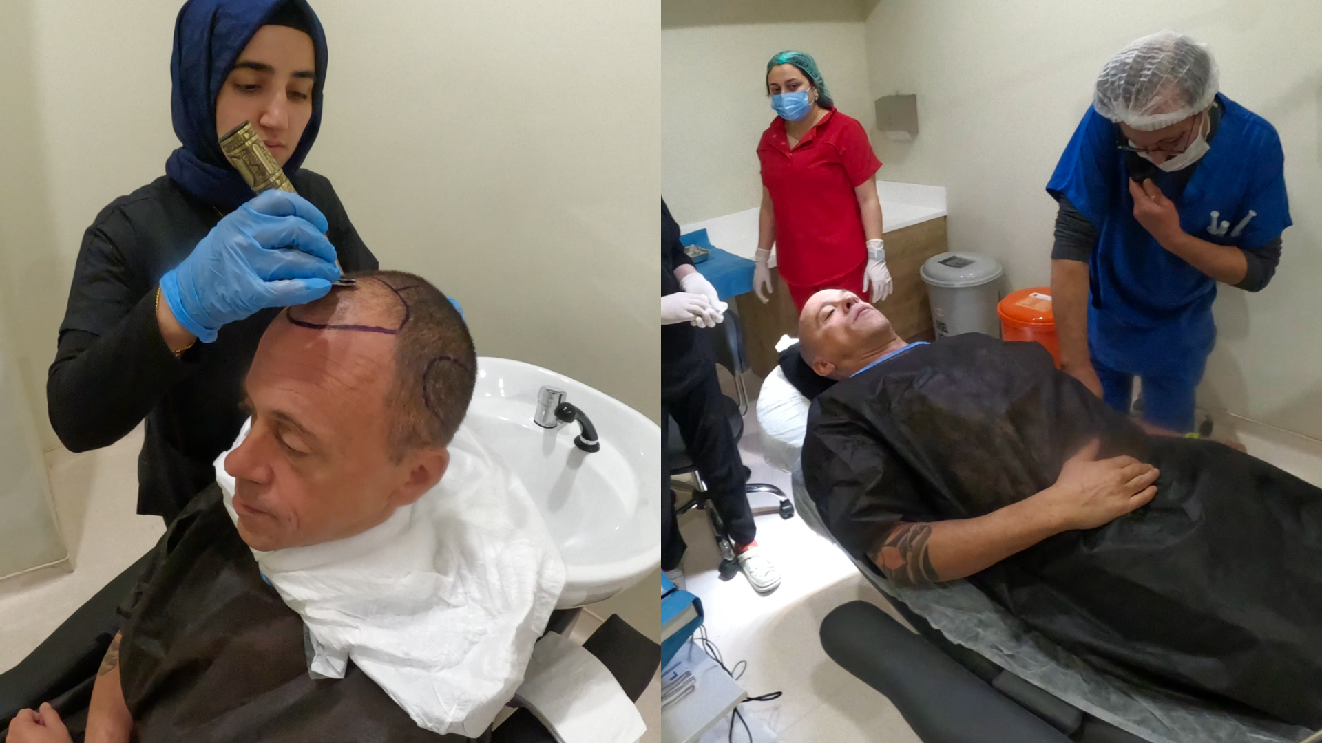 Deux photographies de soins du cuir chevelu réalisés en clinique