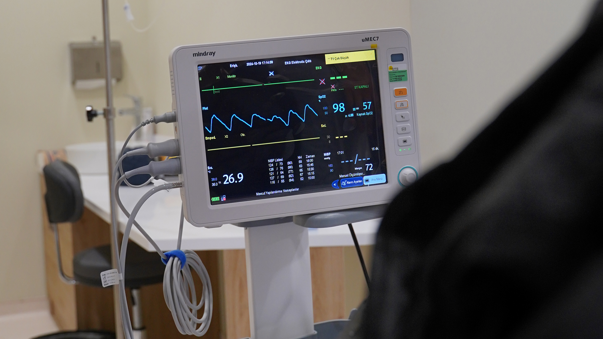 Écran de surveillance médicale affichant des courbes et des valeurs