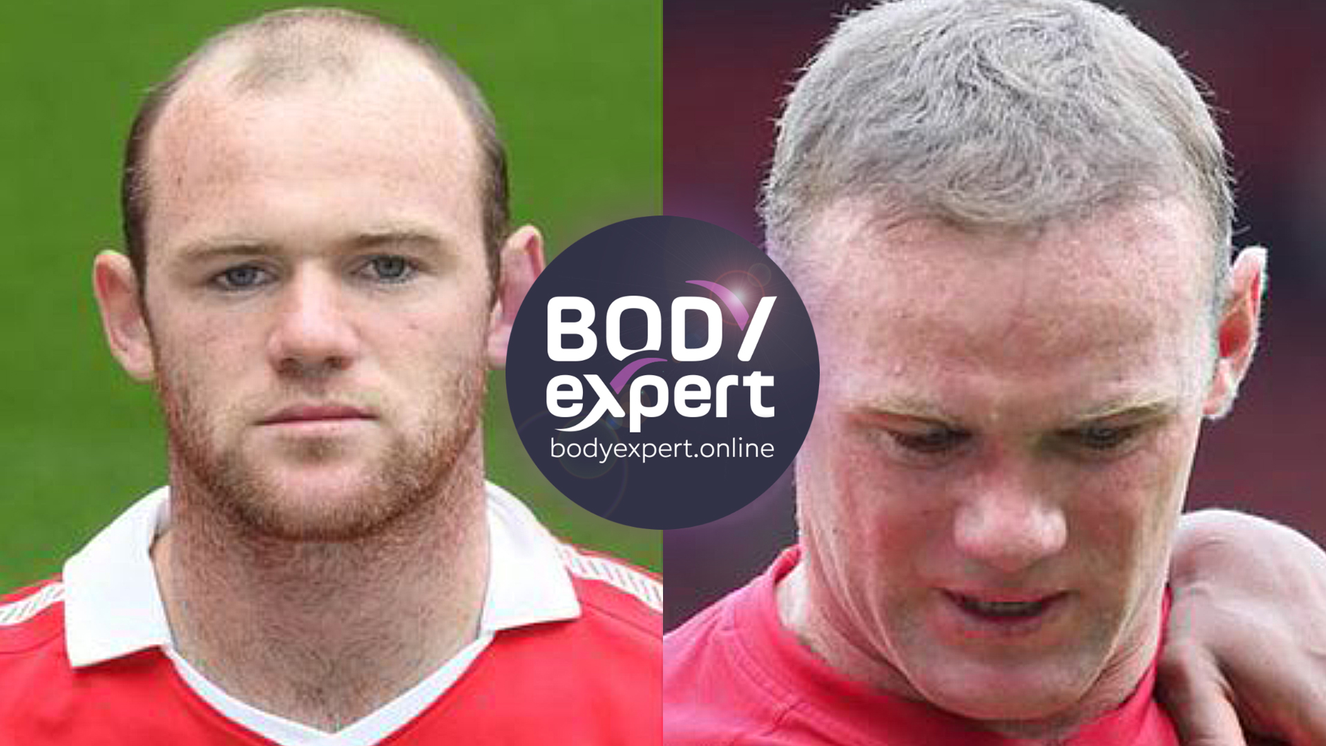 Side-by-side portraits of Wayne Rooney, a very receded hairline in a red football shirt on the left, short thick hair on the right
