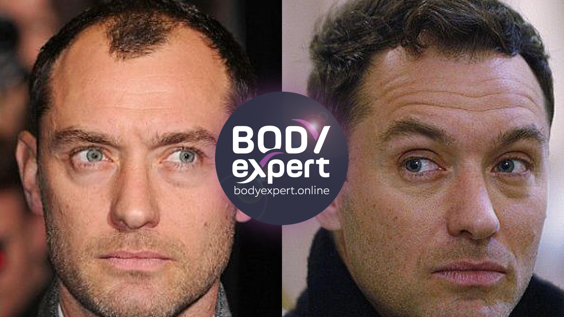 Side-by-side portraits of Jude Law, a high and wide forehead on the left, a lower and denser hairline on the right