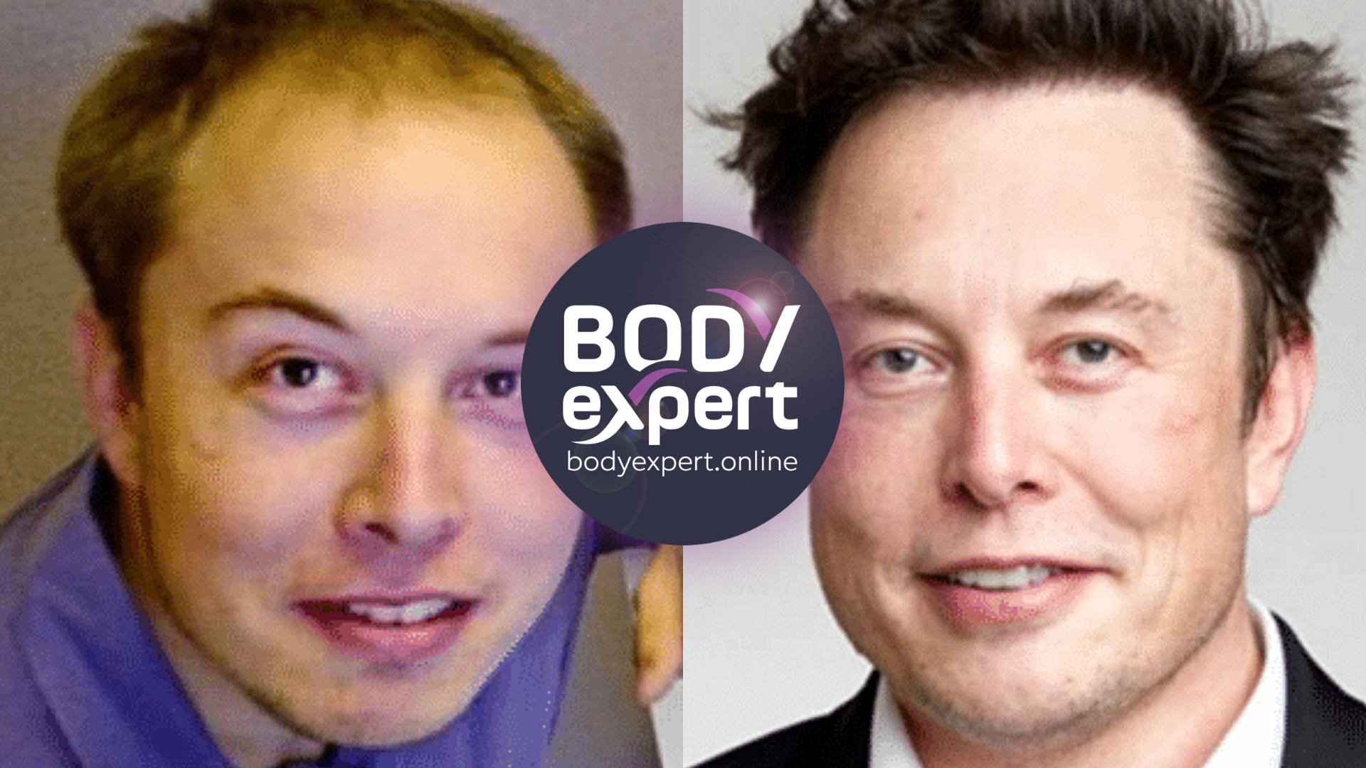 Side-by-side portraits of a young Elon Musk with a thin receding hairline on the left, and a recent portrait with full dark hair on the right