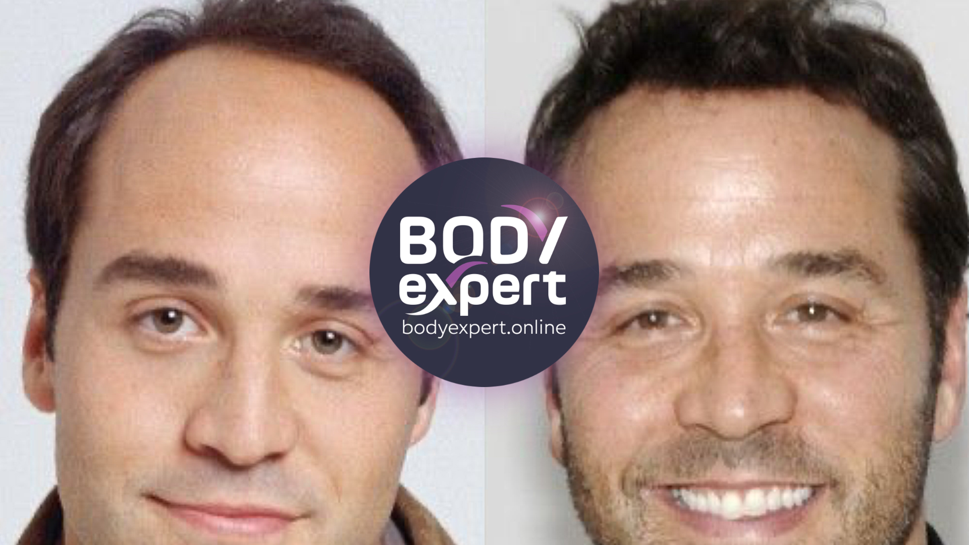 Side-by-side portraits of Jeremy Piven, a thin fine hairline on the left, a fuller and more defined hairline on the right
