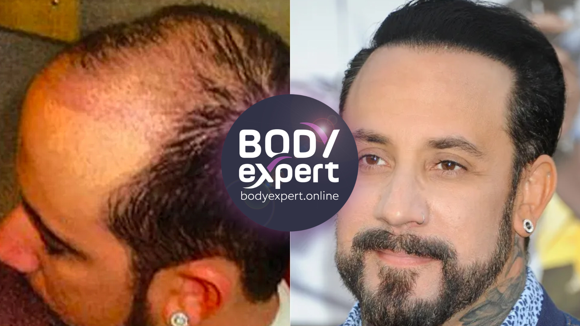 Side-by-side portraits of AJ McLean, an extensively bald crown photographed from above on the left, dark hair and a beard on the right
