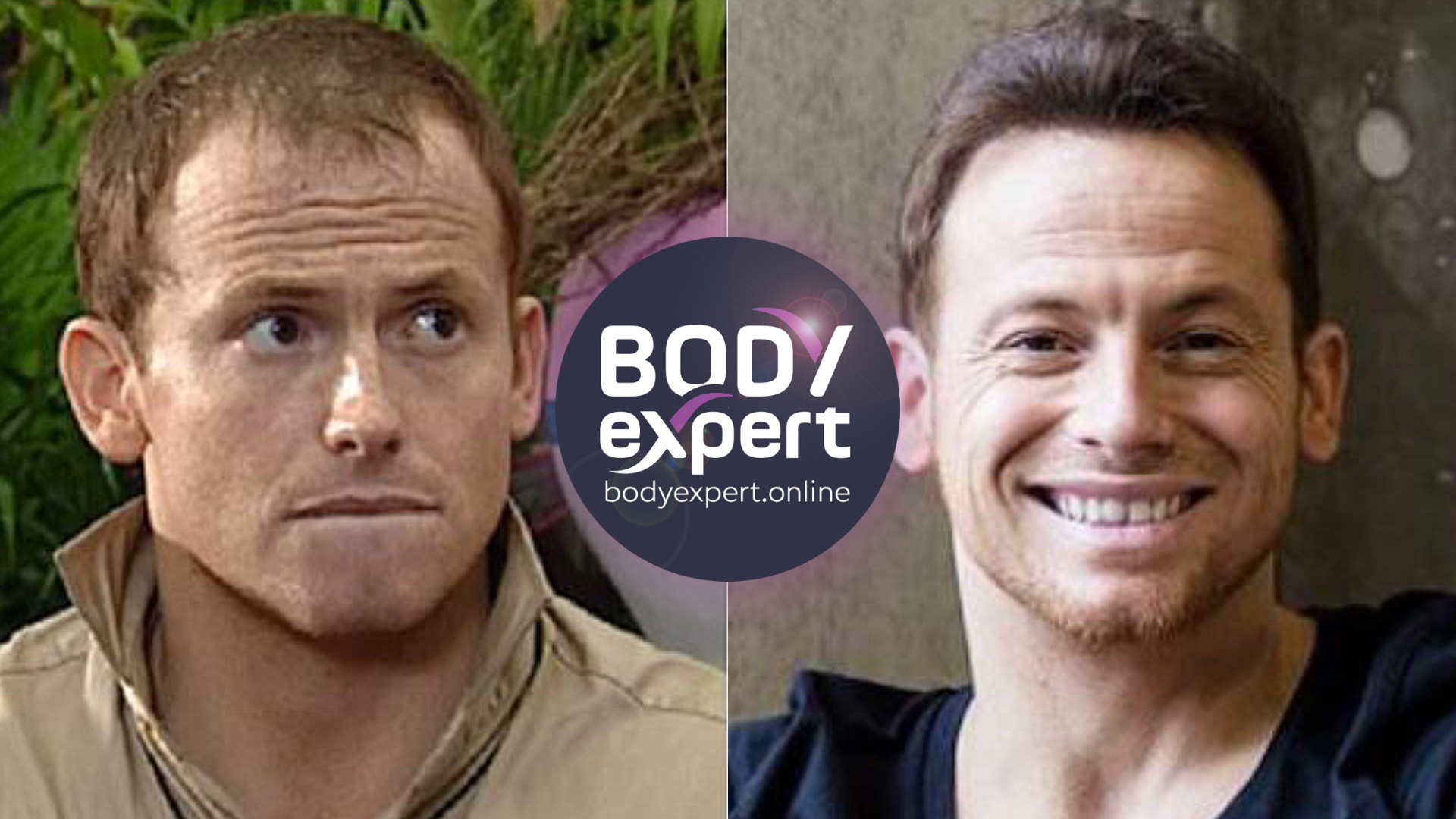 Side-by-side portraits of Joe Swash, thinning hair and a drawn expression outdoors on the left, a full hairline and a broad smile on the right