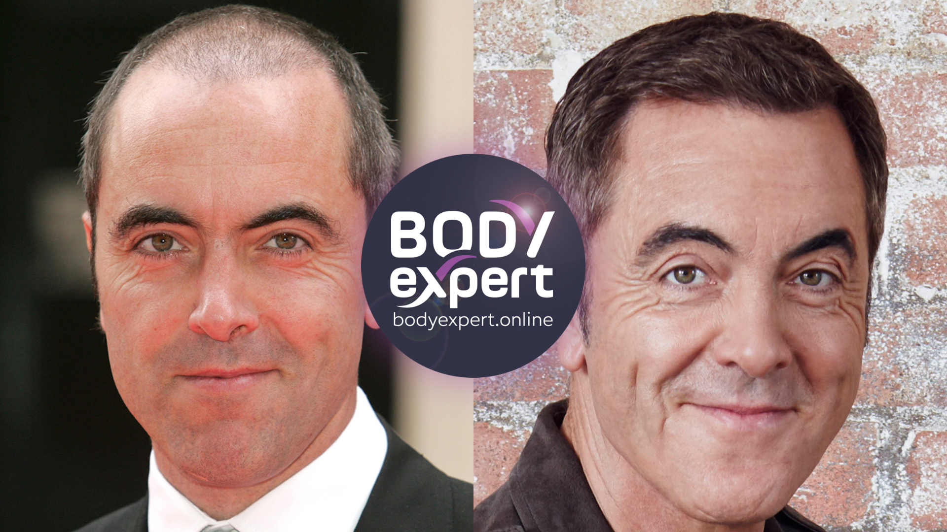 Side-by-side portraits of James Nesbitt, a bald crown and thin sides in a dark suit on the left, dark hair and a broad smile on the right
