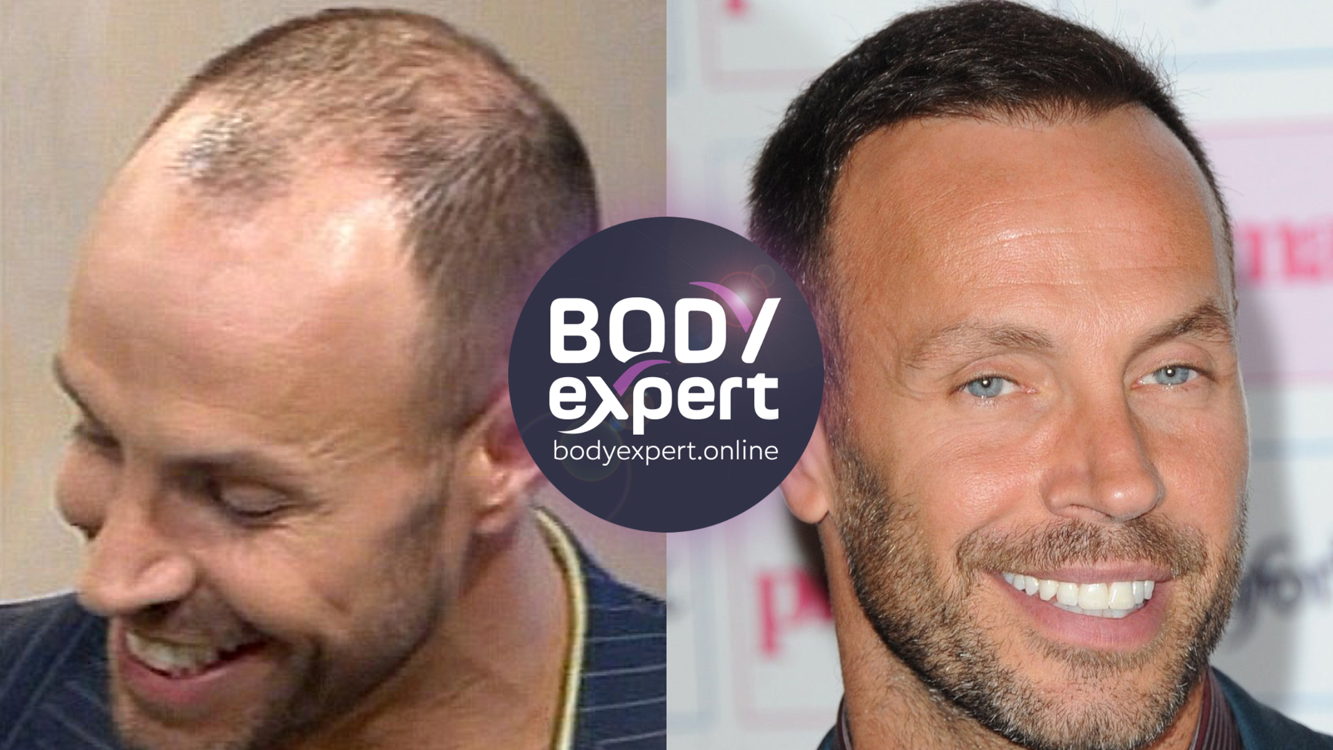 Side-by-side portraits of Jason Gardiner, a balding crown seen in profile on the left, a full head of hair and a beard on the right
