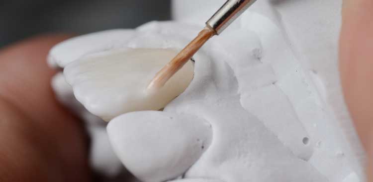 Prothésiste appliquant au pinceau une pâte céramique sur une facette blanche posée près d’un modèle en plâtre