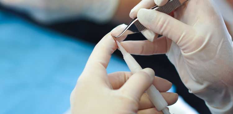 Gloved hands preparing an implanter instrument
