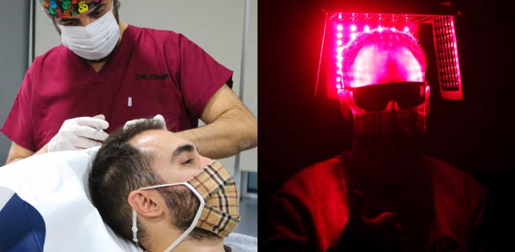 Diptych: a masked practitioner in burgundy scrubs examining the frontal hairline of a man lying down, then a person placed under a red light panel, wearing protective goggles