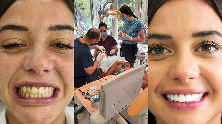 Dental triptych: close-up of Julie Bertin’s teeth before fitting, the dental surgeon and two assistants at work under the operating light, then the finished smile
