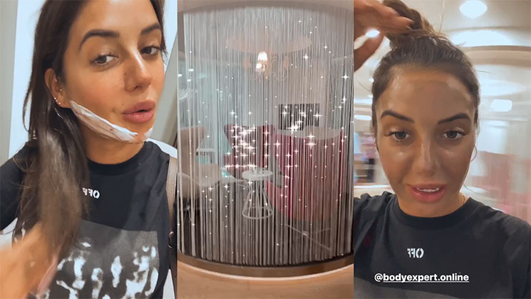 Triptych in story format: Julie Bertin in a treatment room, a white strip along her jaw, a clinic interior behind a curtain of glittering strands, then her face after the treatment, hair pinned up