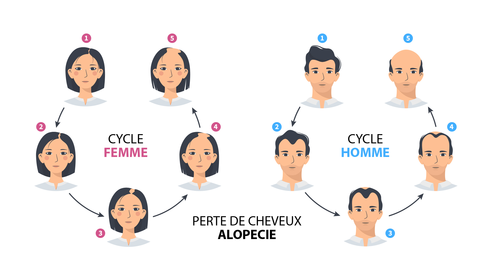 Illustration de plusieurs aspects de dégarnissement masculin et féminin