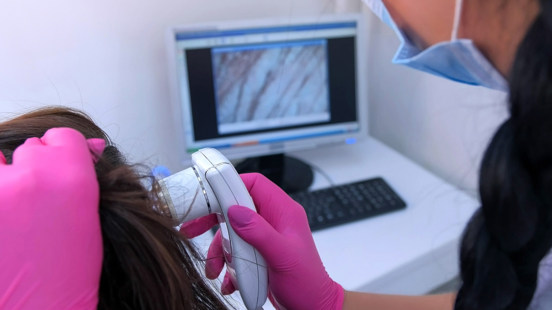 Examen du cuir chevelu avec un appareil relié à un écran