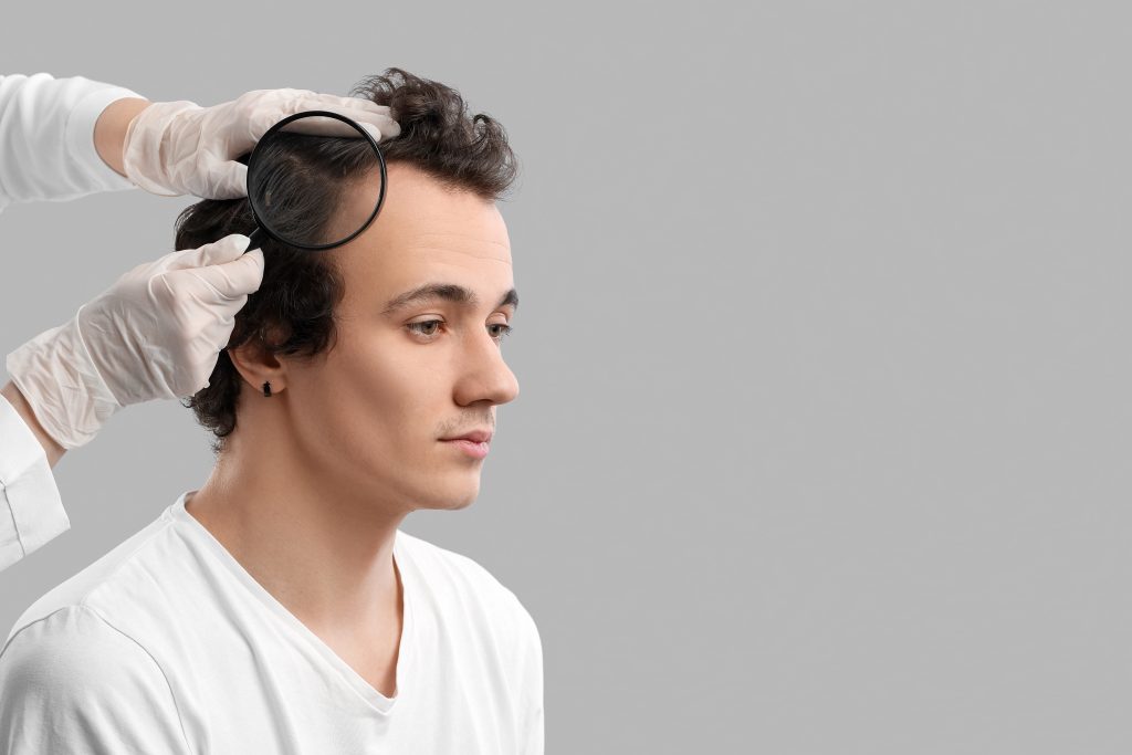 Des mains gantées écartent les cheveux d’un homme et examinent son cuir chevelu à l’aide d’une loupe.