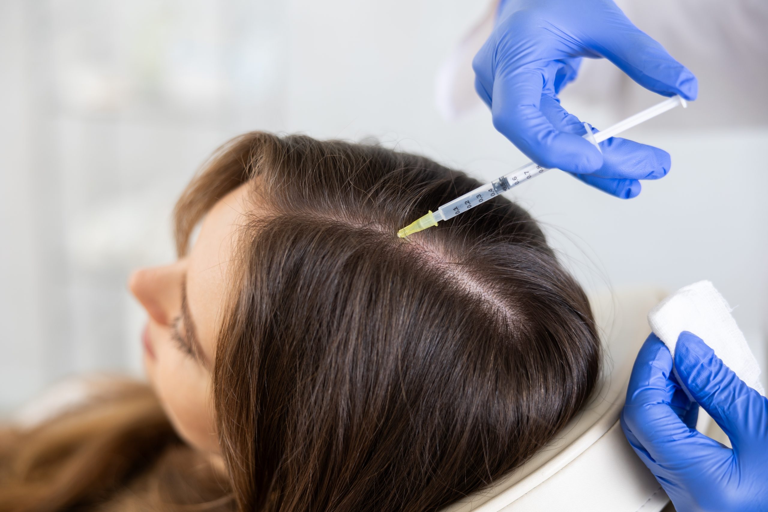 Une main gantée tient une seringue près du cuir chevelu dégagé par une raie dans les cheveux, tandis qu’une autre tient une compresse.